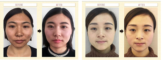 整骨小颜培训_骨雕