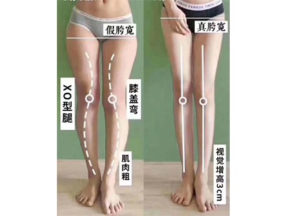 腿型矫正_整骨培训